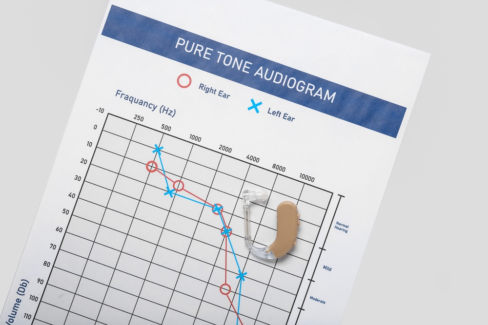 Audiogram.